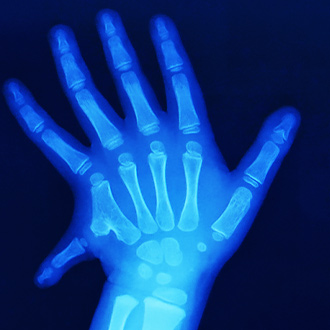Pediatric Orthopedic Disorders clinic