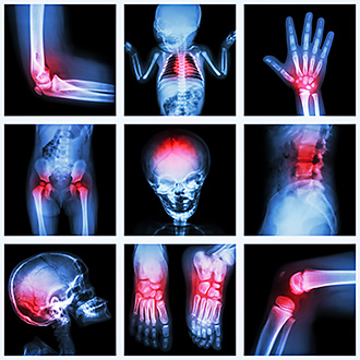 Pediatric Orthopedics clinic