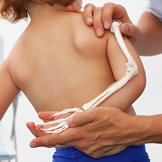 Pediatric Orthopedics doctor